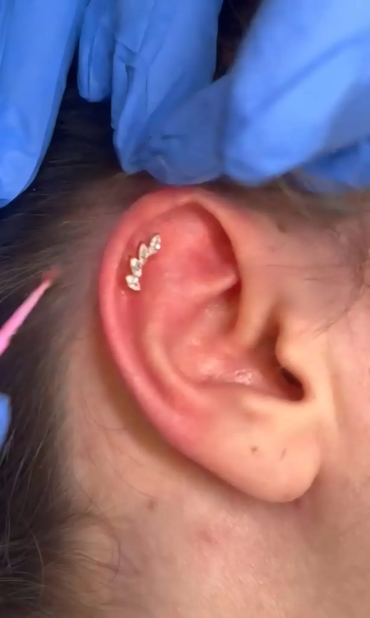 Furo humanizado em bebê