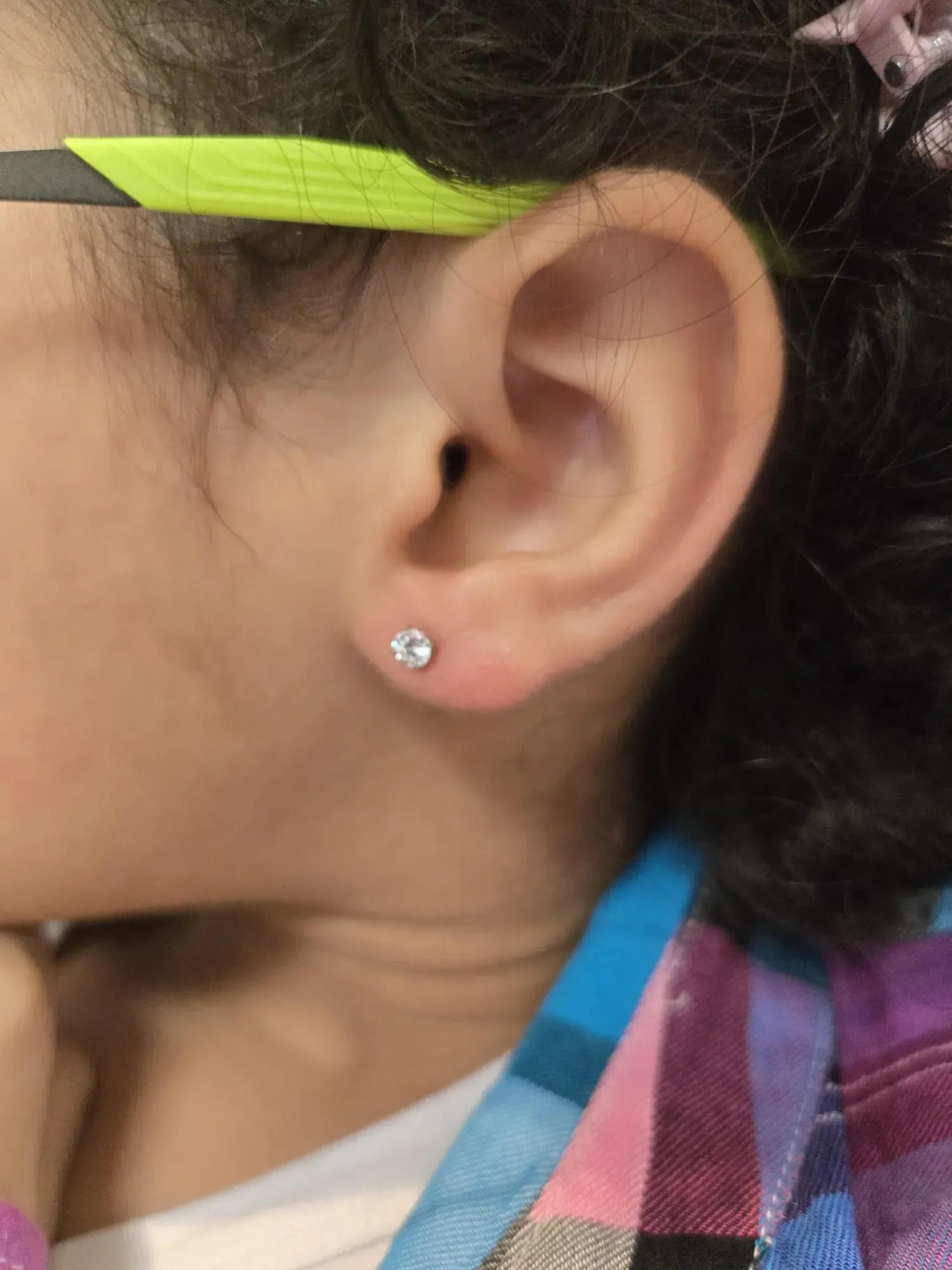 Furo humanizado em bebê